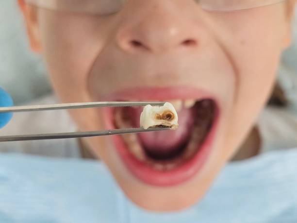 Best Emergency Dental Care for Trauma or Injury in Newark, CA